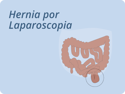 Hernia por Laparoscopia barranquilla colombia
